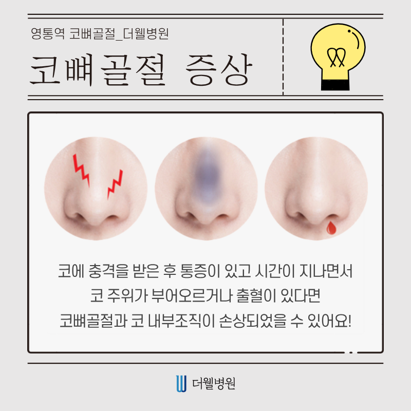 수원 성형외과 _ 코뼈골절, 방치하면 위험합니다! 바로 치료해야 하는 이유 (2/9)