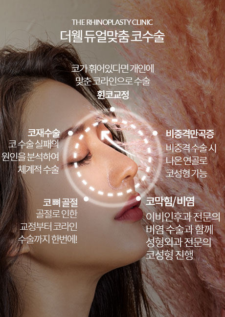 더웰병원 화살코·긴코 교정